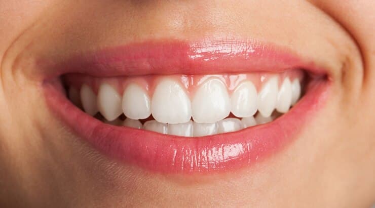 Close-up of a healthy, bright smile