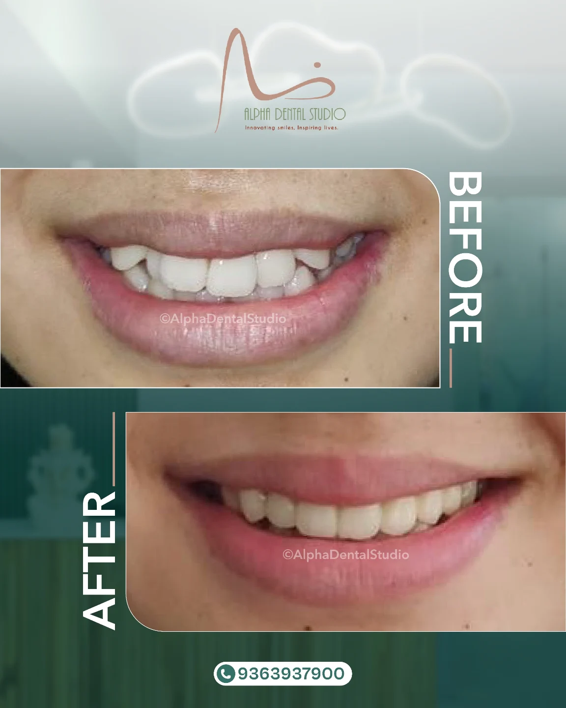 Patient dental transformation before and after treatment